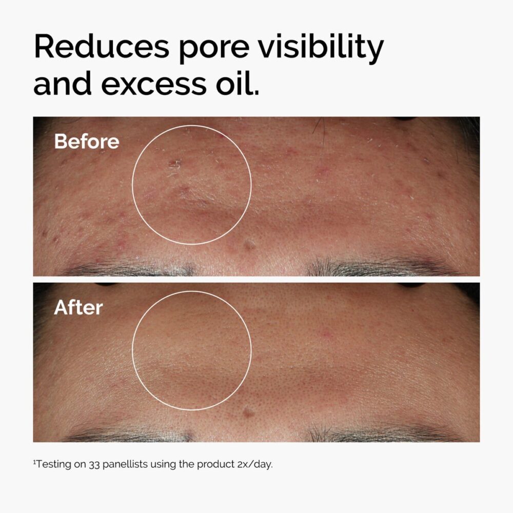Niacinamide 10% + Zinc 1% - Image 5